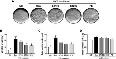 Protective effect of Schizonepeta tenuifolia Briq. ethanolic extract against UVB-induced skin aging and photodamage in hairless mice